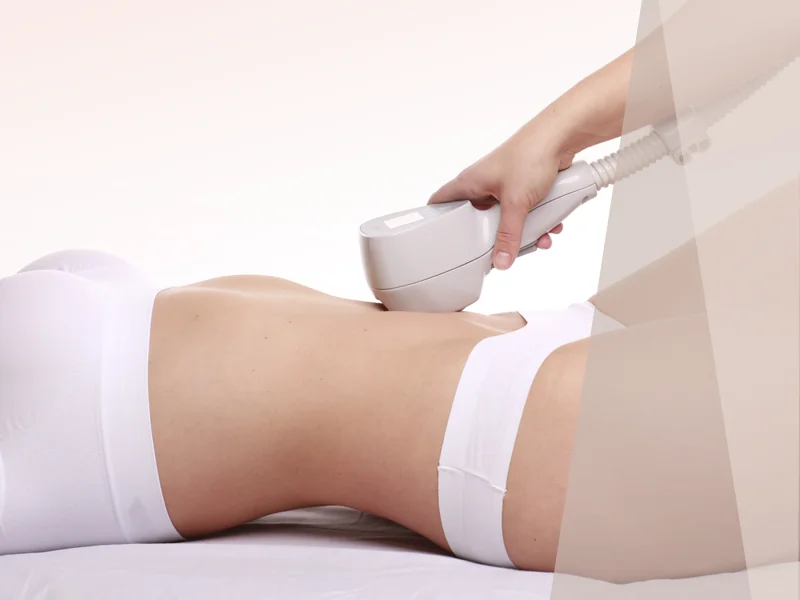 Radio Frequency Skin Tightening Mobile