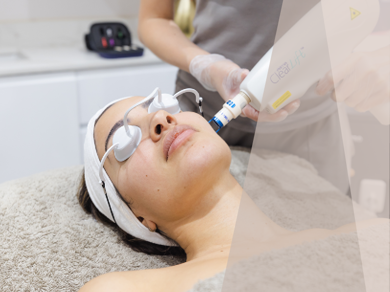 ClearLift Laser Treatment