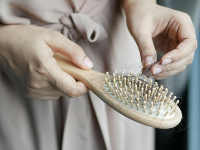 Hair loss treatments in London at Aesthetics Lab