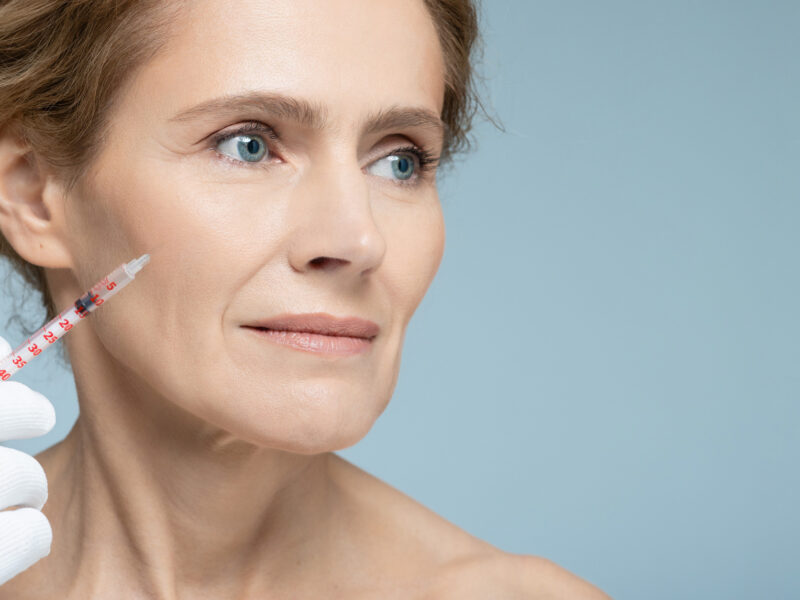 Sculptra treatment - London - Aesthetics Lab